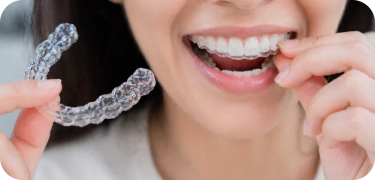 Jahnavee Dental Care | Invisible Braces & Aligners