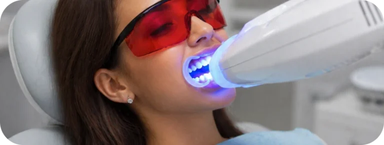 Jahnavee Dental Care | Teeth Whitening