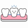 Dental Crowns Bridges Prevents Shifting Of Surrounding Teeth
