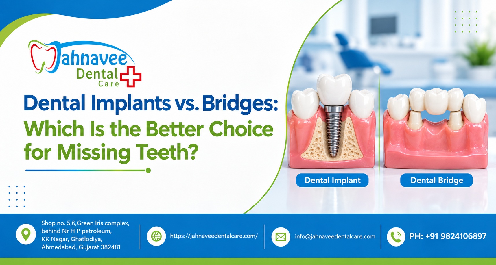 Dental Implants vs. Bridges: Which Is the Better Choice for Missing Teeth?