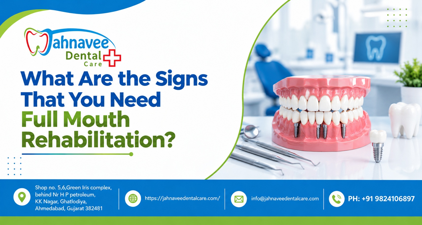 What Are the Signs You Need Full-Mouth Rehabilitation?
